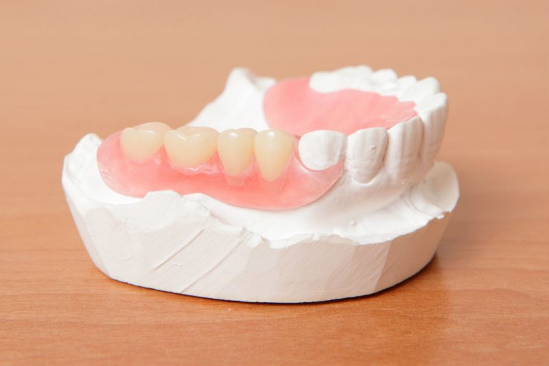 Thing You May Encounter When Getting Your First Denture