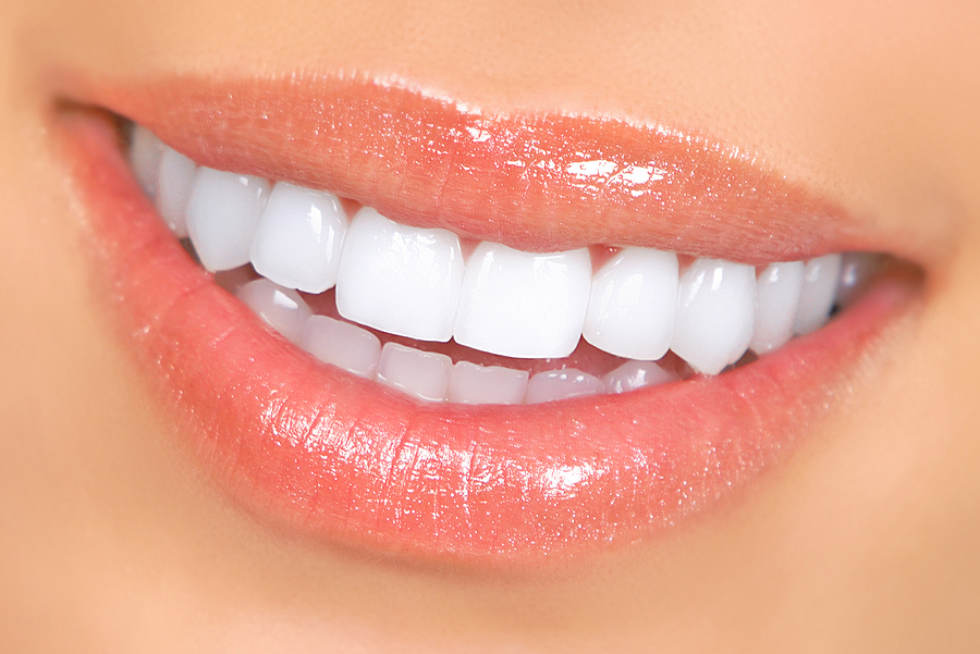 Dental Porcelain Caps/Crowns