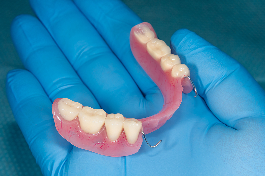 Understanding Removable Partial Dentures in Vero Beach, FL: A Comprehensive Guide